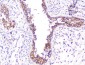 Anti-beta Catenin CTNNB1 Antibody Picoband™ (monoclonal, 1F6)